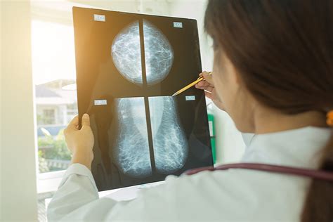 leesburg breast cancer mammogram images